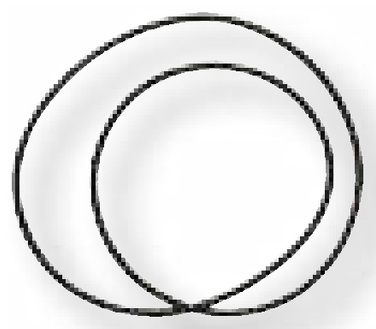DANA Spicer O-ring - bucsa